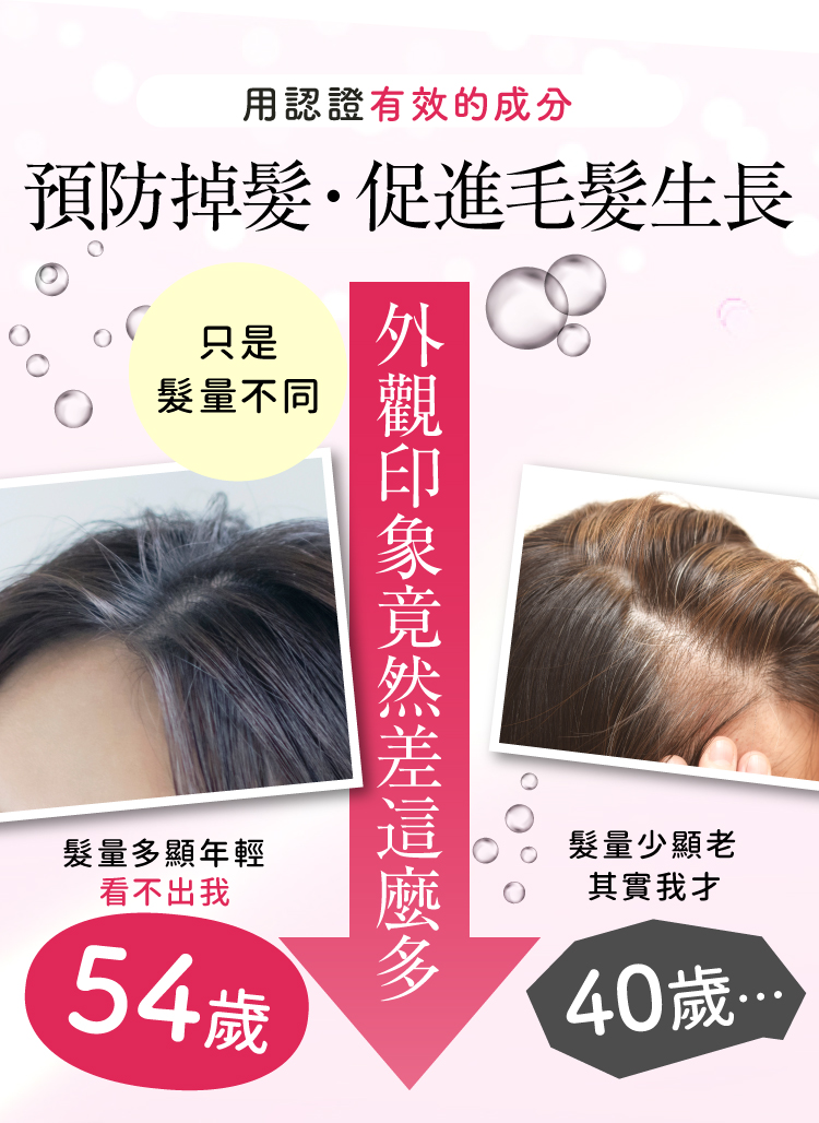 預防掉髮