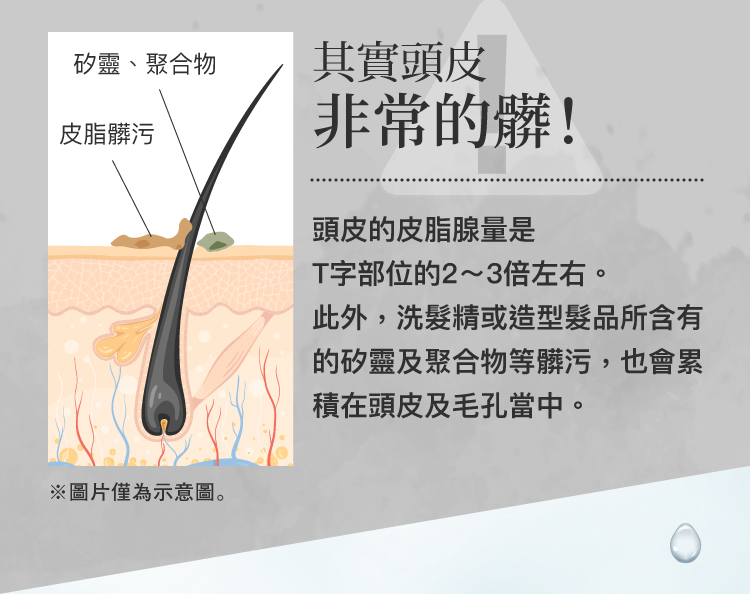 頭皮髒污
