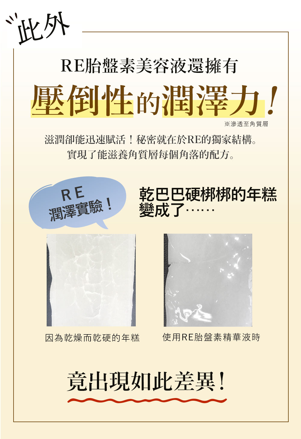 差異